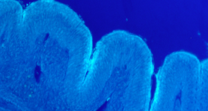 Bacillus subtilis can create a protective Biofilm on the intestinal epithelium